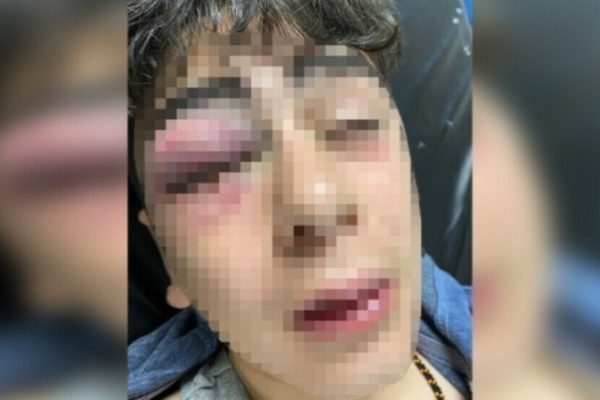 3 полицейских, избивших ребенка в Лидже, освобождены