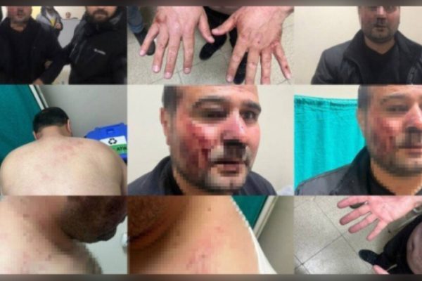 Полицейское насилие в Джолемерге