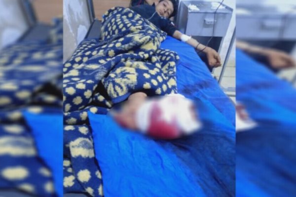 В Шахбе от турецких атак пострадали двое детей