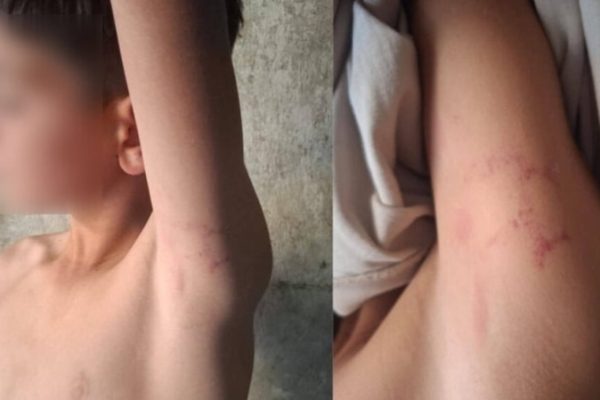 Директор школы в Африне избил 12-летнего курдского ребёнка