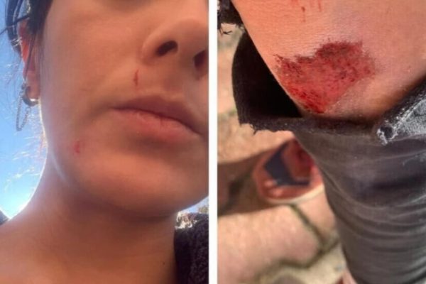 Журналистка Эзги Сойсал заявила о нападении: десять человек напали на меня, чтобы убить