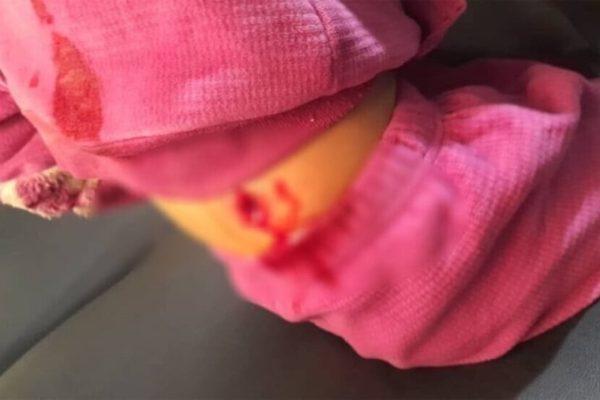 В Дейр-Хафере силы Переходного правительства ранили 7-летнего ребёнка при нападении