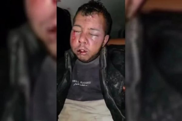 В результате нападения турецких солдат в Сарекание пострадали пять человек