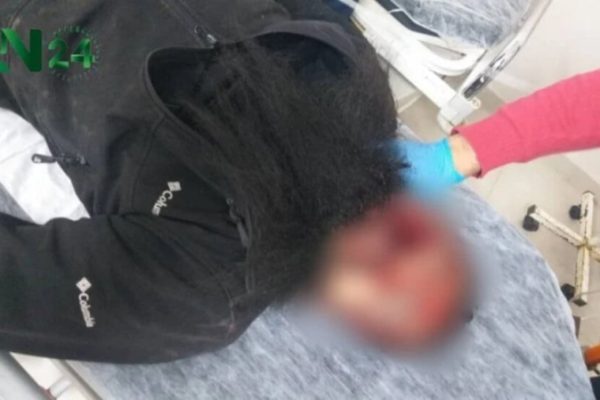 Молодой человек из сельской местности Африна погиб от пули боевиков