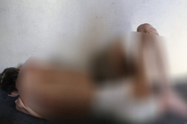 Житель Африна умер от последствий пыток, совершённых протурецкими боевиками