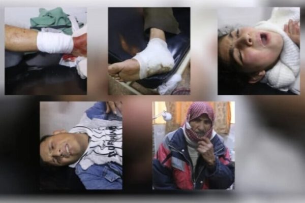 Число жертв обстрелов осаждённых кварталов Алеппо возросло до 72 человек