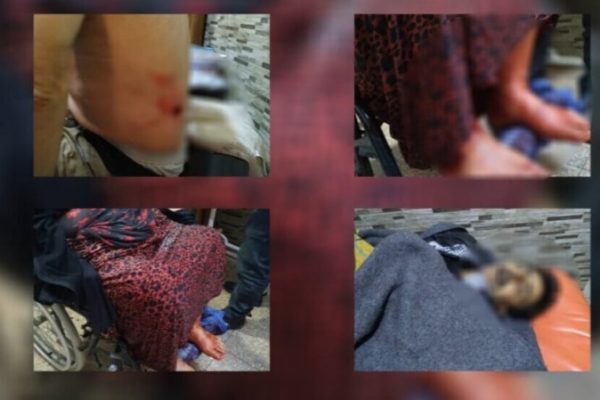 Продолжающиеся атаки на курдские кварталы Алеппо приводят к новым жертвам среди мирных жителей